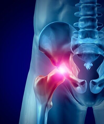 durere de șold fotografie 1